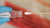 Coronavirus: el promedio de casos en Entre R&iacute;os es el m&aacute;s bajo desde principios de abril