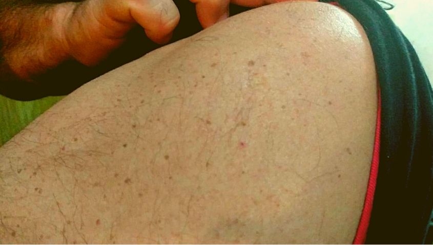 Todo lo que cabe en un pinchazo