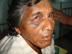 Una Primavera sin flores