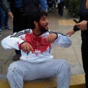 Decenas de heridos por repressi&oacute;n en Rawson, Chubut 